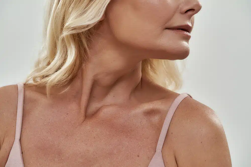 Profile view of a mature woman's chin, illustrating the sagging skin characteristic of a witch's chin.