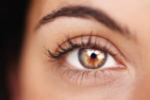blepharoplasty Miami