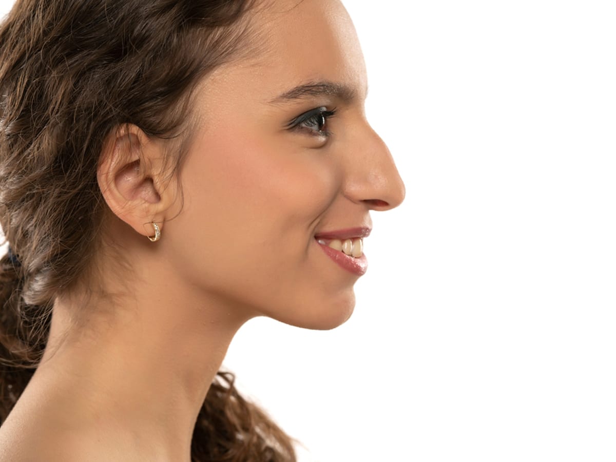 To remove a dorsal hump you can trust an experienced rhinoplasty surgeon, like Dr. Bustillo, to provide the best results.