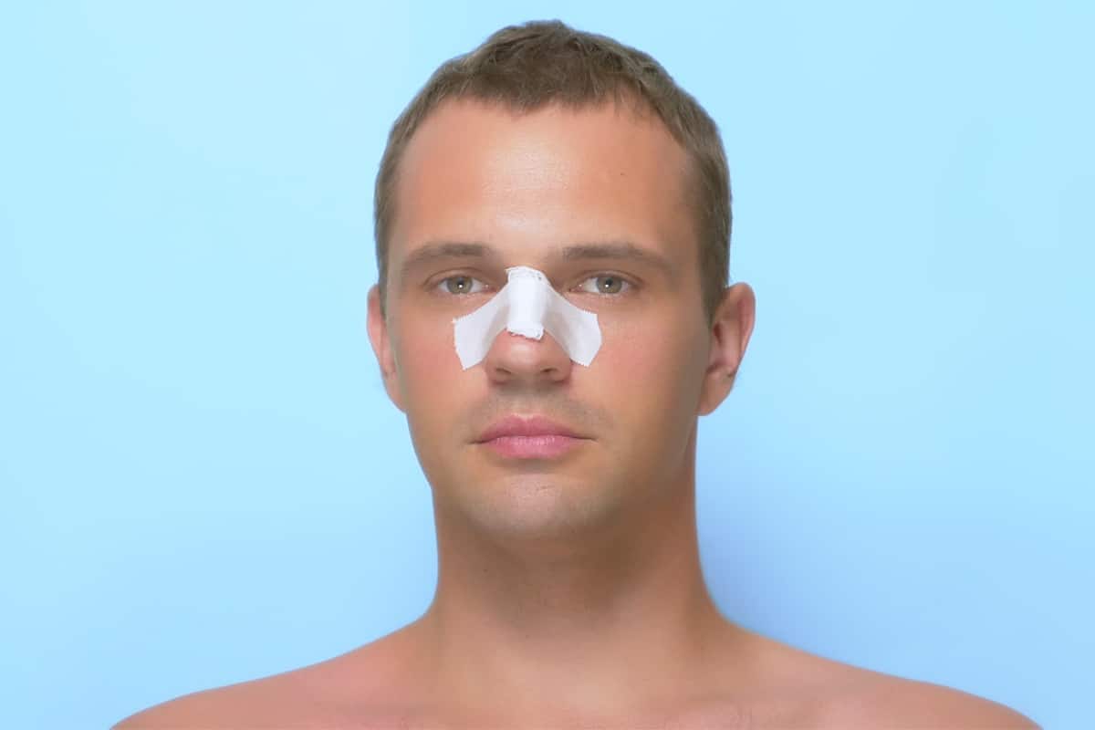 A patient looking forward to improved facial features after their revision surgery in Miami, FL.