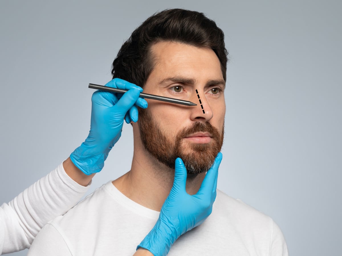 People suffering from crooked noses and frequent sinus infections or nasal congestion may find relief with a functional rhinoplasty as well as improve their facial features