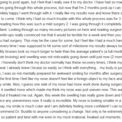 Attachment for Patient from Realself review