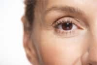 Who's a Candidate for Blepharoplasty