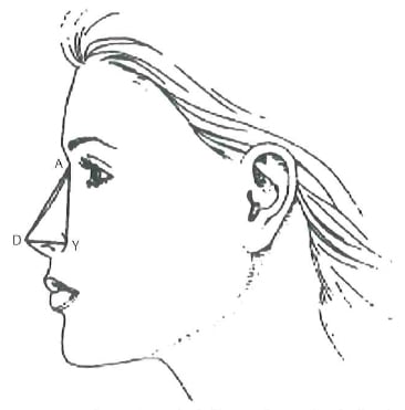 Diagram of Nasal Tip Projection Measurement