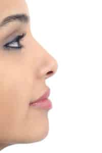 Rhinoplasty over-projected Tip