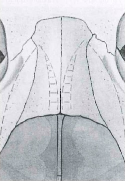 Diagram of Nasal Bones