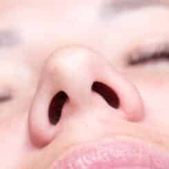 Close-up of a patient's nose after rhinoplasty surgery, emphasizing the importance of minimizing scar tissue formation.