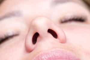 Close-up of a patient's nose after rhinoplasty surgery, emphasizing the importance of minimizing scar tissue formation.