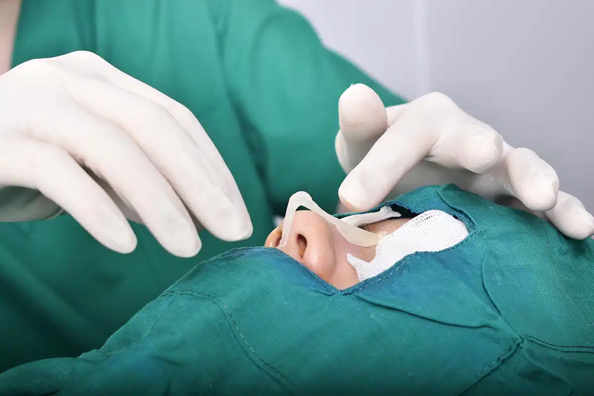 The cost of rhinoplasty materials can vary depending on what is used in the surgery