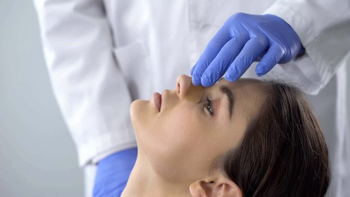 Cómo realizar una rinoplastia.