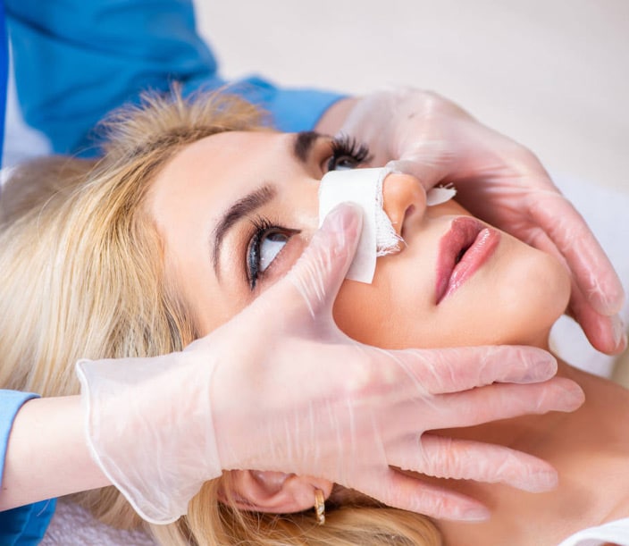 Recovery and Healing Time of Rhinoplasty Surgery.