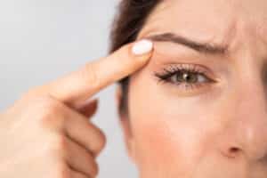 Revision blepharoplasty corrects complications or enhances outcomes from a previous blepharoplasty