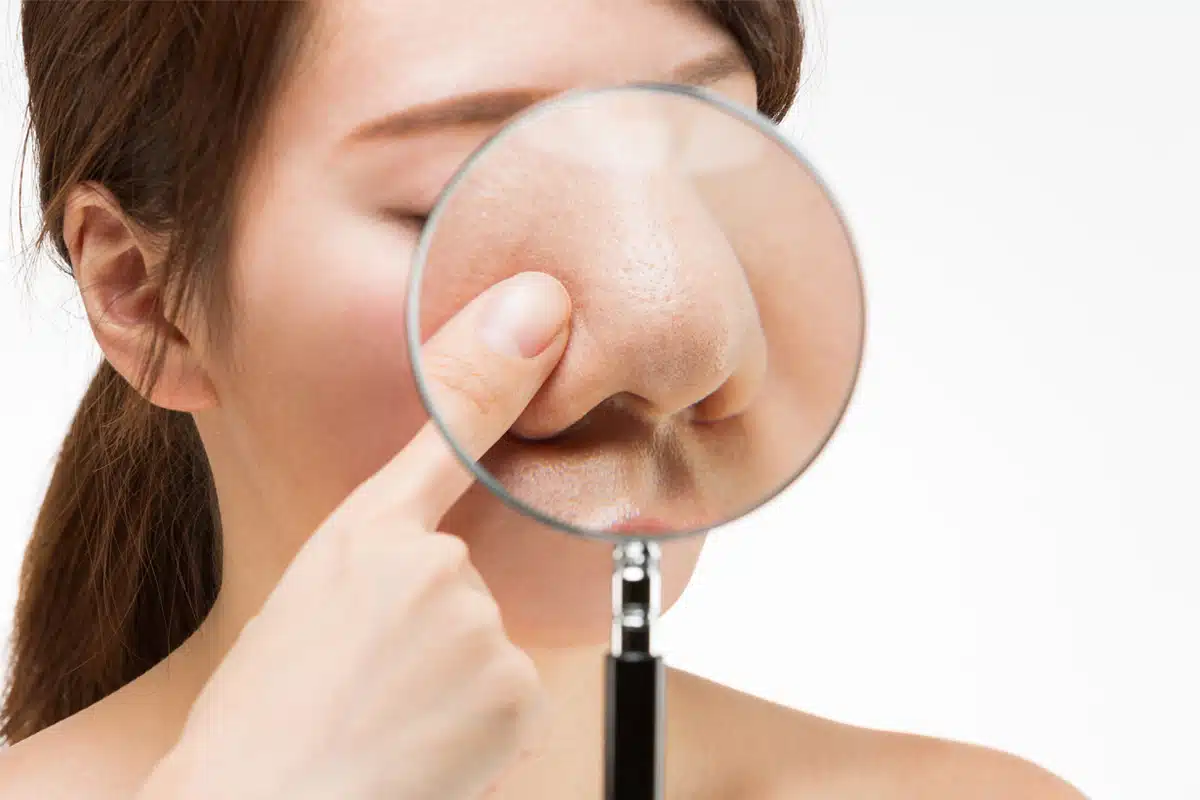 Dr. Bustillo offers specialized techniques to reduce bulbous noses with rhinoplasty, helping patients achieve the facial aesthetics they desire.