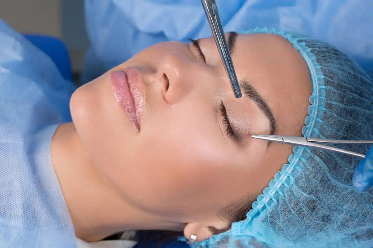 Upper eyelid surgery can reduce excess skin and fat, improve vision, and give a more youthful appearance.