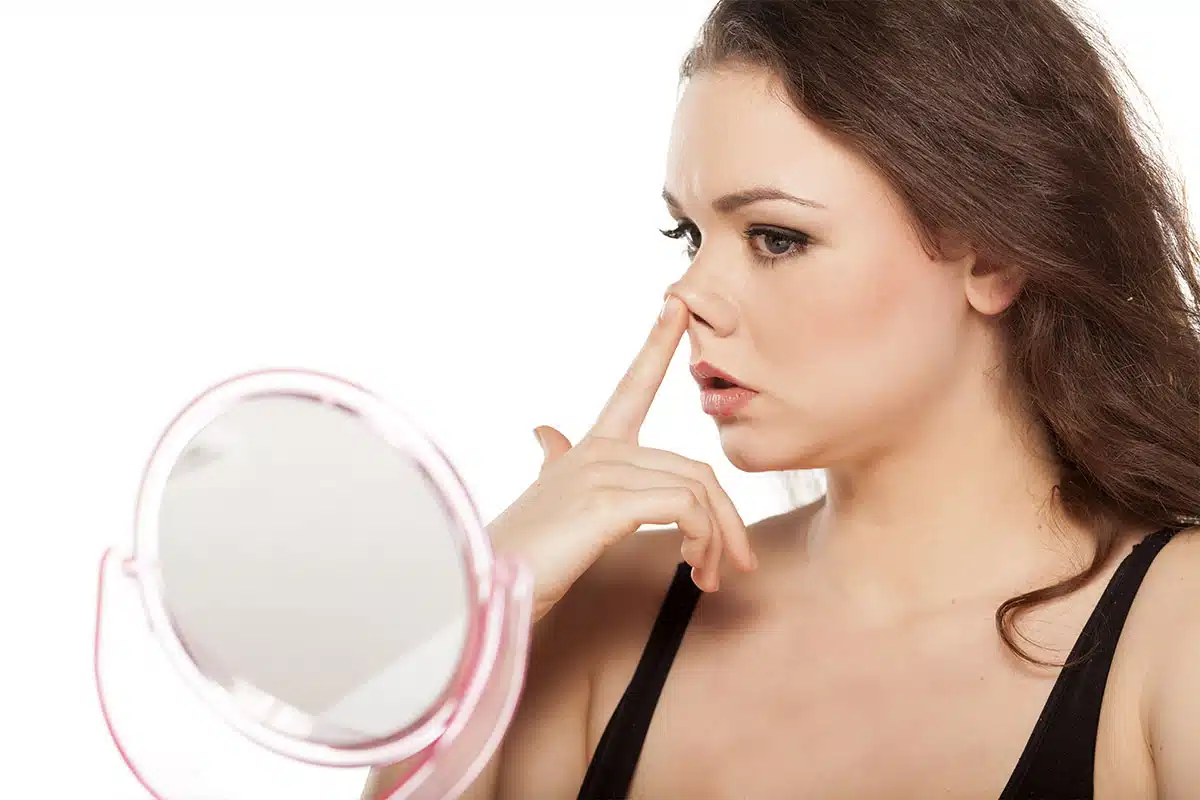 The 'piggy nose' effect after rhinoplasty is when the tip of the nose appears overly upturned and too small, resembling a pig's nose.