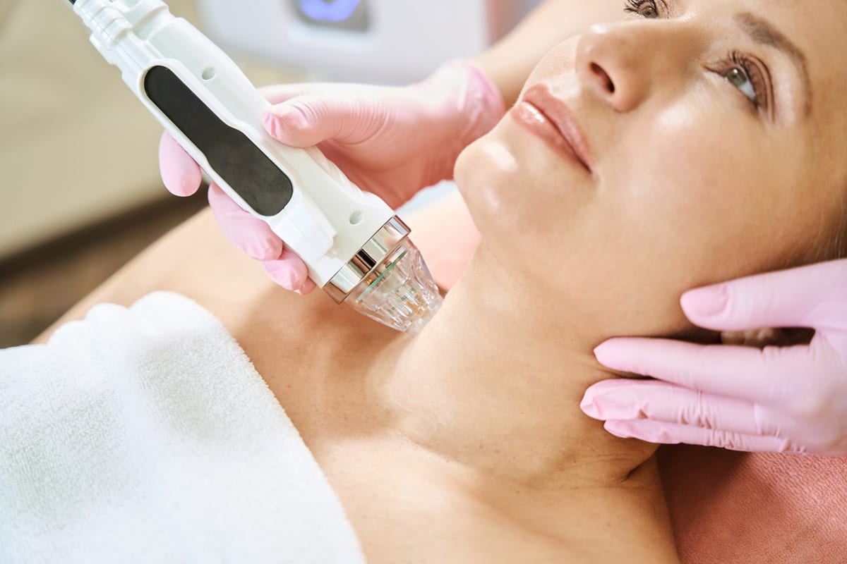 Close-up of microneedling RF treatment on patient's neck for skin tightening.