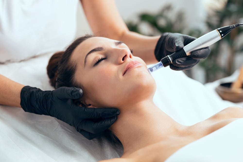 Close-up of microneedling therapy on woman's face for collagen stimulation and skin rejuvenation.