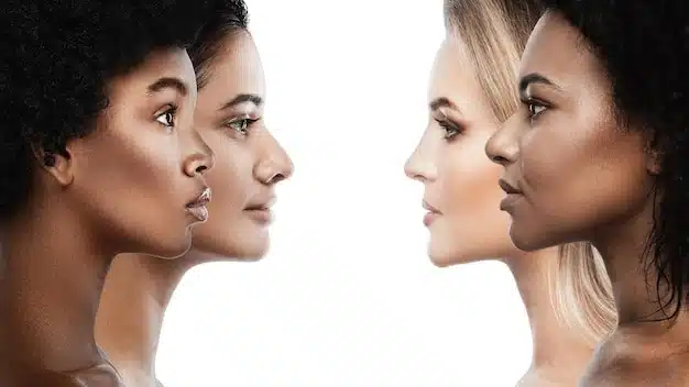 Four diverse women in profile showcasing different nasal shapes, indicating rhinoplasty variations.