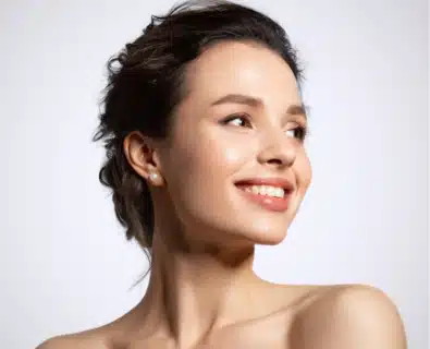 Woman after Dermal Fillers performed by Dr. Bustillo.