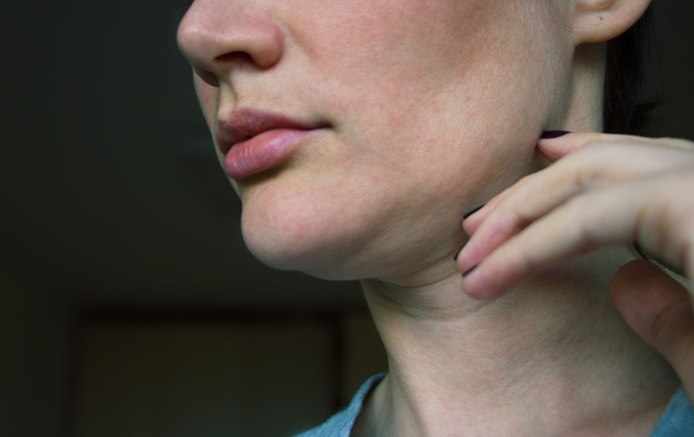 Close-up of a woman’s lower face showing early jowling and skin laxity due to aging and ligament weakening