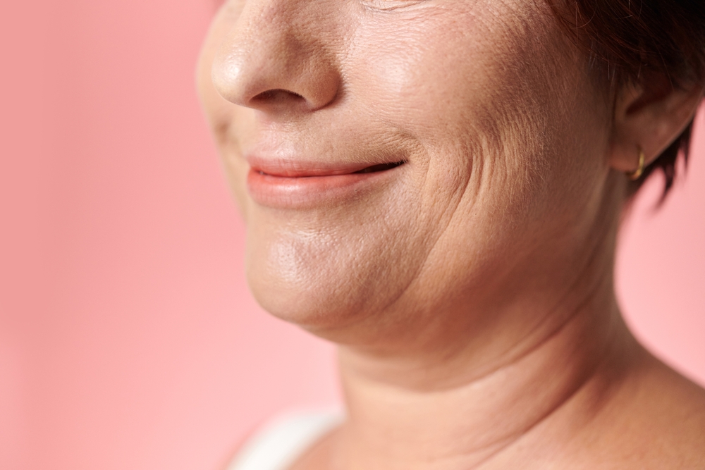 Close-up of lower face showing early jowling, highlighting genetic factors that may lead to early facelift consideration.