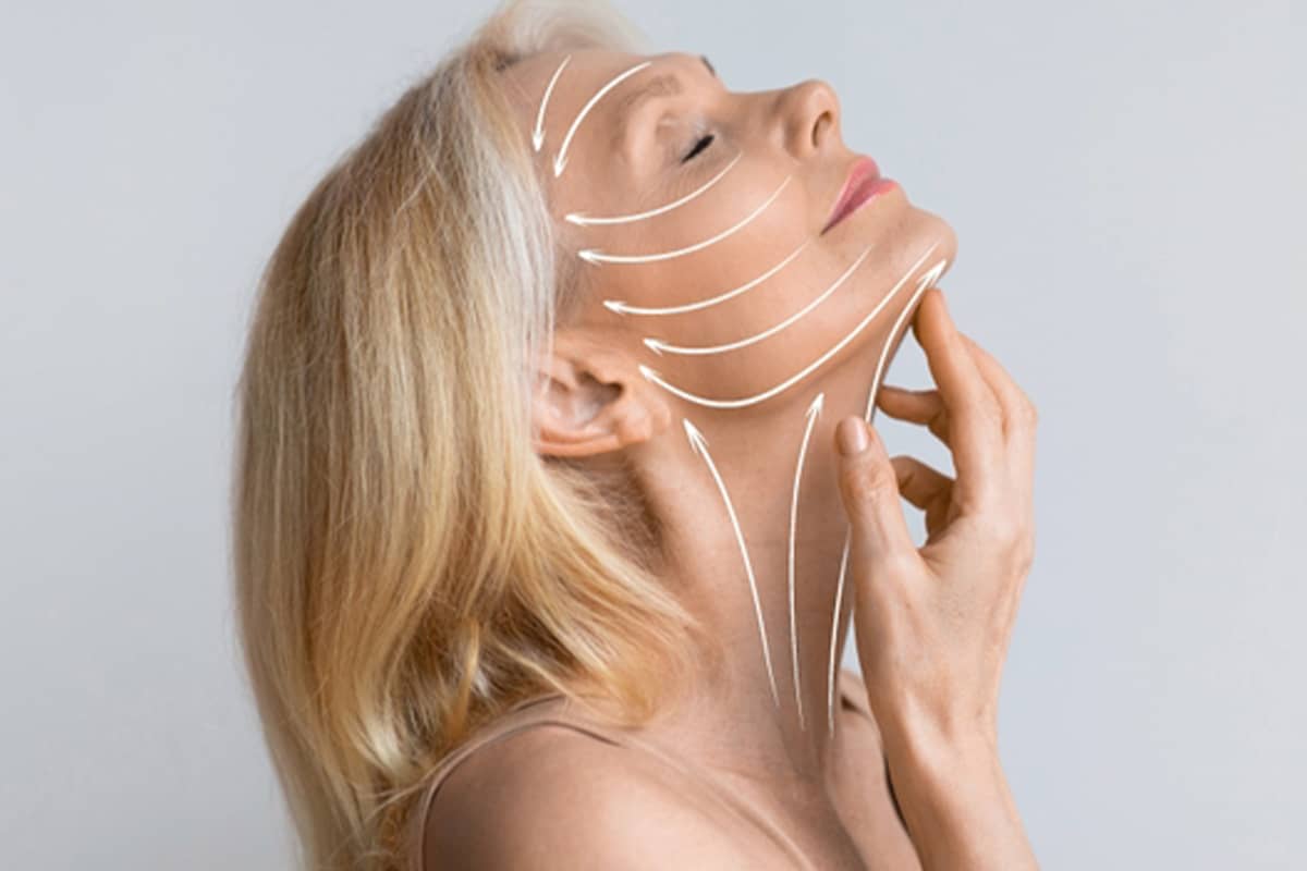 Profile view of a woman with white arrows illustrating the deep plane facelift vectors that lift the jawline, neck, and midface simultaneously for lasting results.
