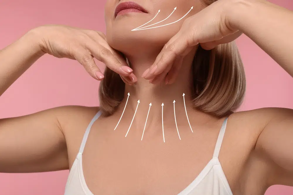 Woman touching chin and neck with arrows showing lift direction, illustrating facelift vs fillers and structural aging effects